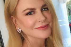 Николь Кидман сломала ногу на пробежке