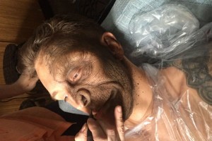 Рэпер T-killah показал свое изуродованное лицо
