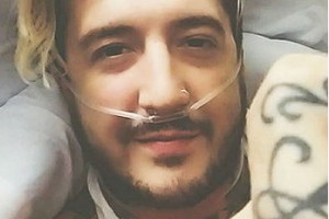 Остин Карлайл рассказал о неизлечимой болезни