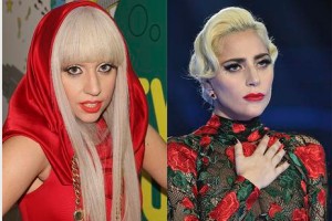 Пользователи Twitter уверены, что Леди Гага — жертва пластики