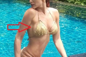 У экс-«ВИА Гры» проблемы с силиконовой грудью