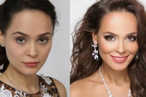 Модель Анна Калашникова сделала еще одну пластическую операцию