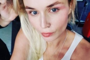 Поклонники Полины Гагариной обеспокоены ее изможденностью