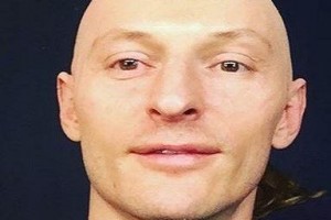 Павел Воля шокировал поклонников лысой головой
