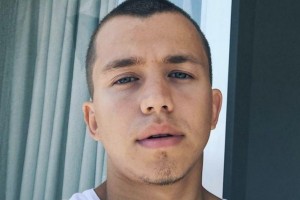 Актер популярных сериалов пересадил волосы с затылка на лицо.