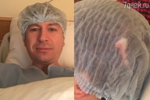 Алексей Ягудин перенес операцию на голове