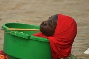 Девушка без рук и ног вынуждена жить в пластиковом тазу. Невероятно, но факт