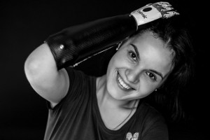 Маргарита Грачева: как сейчас живет девушка, которой муж отрубил кисти обеих рук