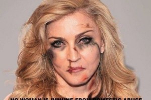 Фото избитой Мадонны взорвало сеть интернета