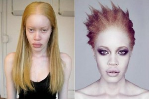 Афроамериканка-альбинос стала востребованной моделью