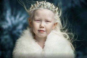 «Сибирская Белоснежка»: 8-летняя девочка-альбинос из Якутии стала звездой Сети