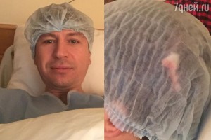 Алексей Ягудин перенес операцию на голове