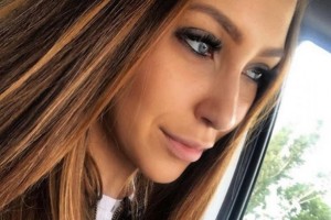 У Алены Савкиной рассасываются губы, отпадают наращенные волосы, ресницы