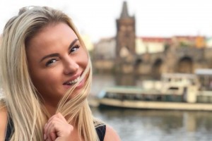 АННА, ЭТО ВЫ? ПОКЛОННИКИ ШОКИРОВАНЫ РЕЗКИМ ПОХУДЕНИЕМ АННЫ СЕМЕНОВИЧ